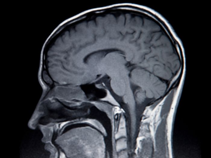 head-scan-mri